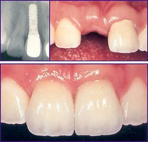 Happy Tooth CMI Dr. Alina-Maria Diaconu - cabinet stomatologic