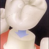 Happy Tooth CMI Dr. Alina-Maria Diaconu - cabinet stomatologic