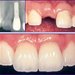 Happy Tooth CMI Dr. Alina-Maria Diaconu - cabinet stomatologic